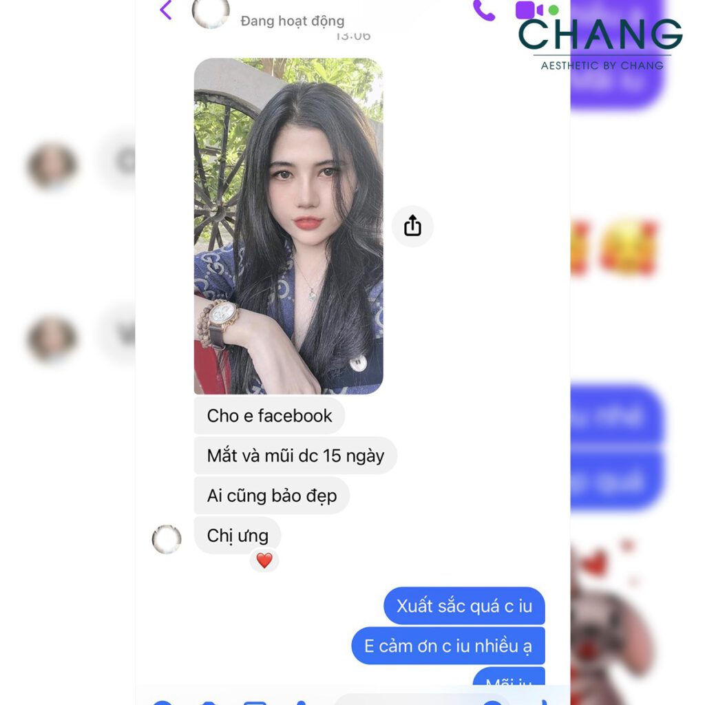 Cánh mũi thon gọn, dáng mũi xinh xắn