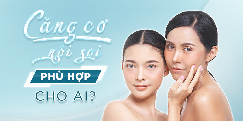 căng cơ nội soi dành cho ai