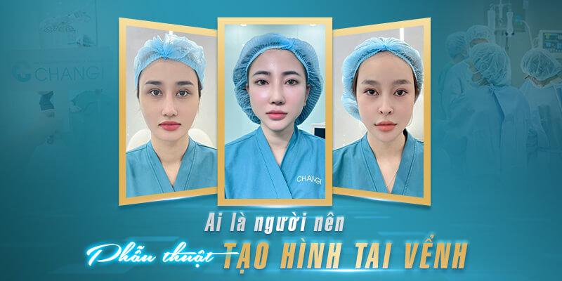 Đối Tượng Nên Phẫu Thuật Tạo Hình Tai Vểnh