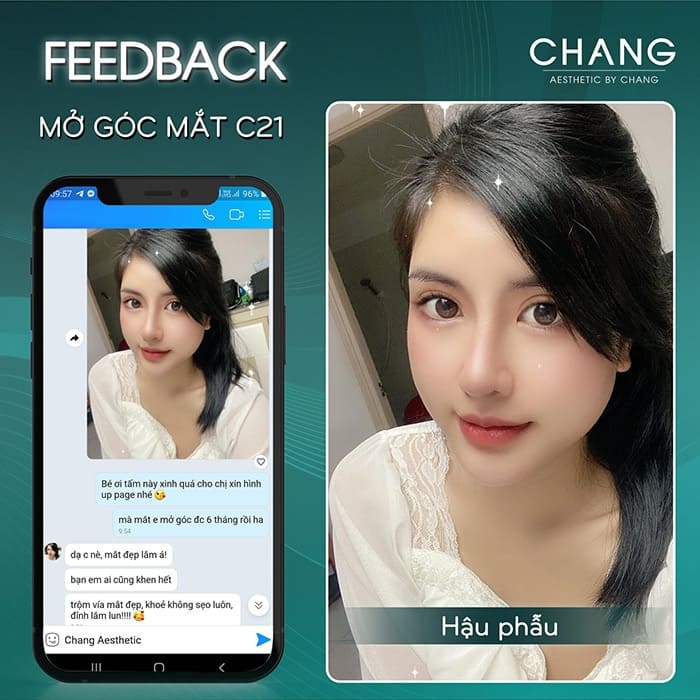 Khách nhận xét sau khi mở rộng góc mắt